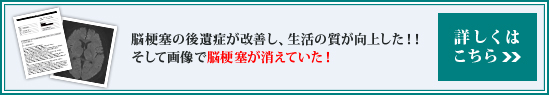 脳梗塞の後遺症が改善し、生活の質が向上した！！そして画像で脳梗塞が消えていた！